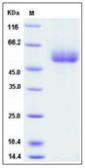 Human Apolipoprotein H protein, His tag. GTX01348-pro