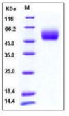Human FGFR1 protein, His tag (active). GTX01356-pro