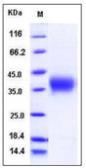 Human Activin Receptor Type IIA protein, His tag (active). GTX01411-pro