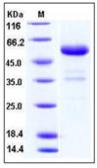 Human CTLA4 protein, human IgG1 Fc and His tag (active). GTX01419-pro