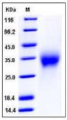 Mouse Activin Receptor Type IIA protein, His tag (active). GTX01429-pro