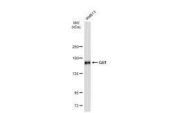 Anti-Gli1 antibody [JF09-08] used in Western Blot (WB). GTX01449