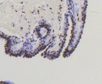 Anti-SMAD5 (phospho Ser463/Ser465) antibody [SY09-03] used in IHC (Paraffin sections) (IHC-P). GTX01450