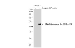 Anti-SMAD5 (phospho Ser463/Ser465) antibody [SY09-03] used in Western Blot (WB). GTX01450