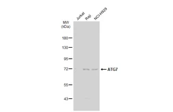 Anti-ATG7 antibody [GT1218] used in Western Blot (WB). GTX01526