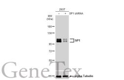 Anti-SP1 antibody [GT1220] used in Western Blot (WB). GTX01528