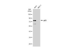 Anti-p63 antibody [GT1221] used in Western Blot (WB). GTX01529