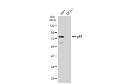 Anti-p63 antibody [GT1221] used in Western Blot (WB). GTX01529