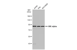Anti-IKK alpha antibody [GT1224] used in Western Blot (WB). GTX01532