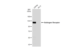 Anti-Androgen Receptor antibody [GT1228] used in Western Blot (WB). GTX01536