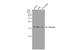 Anti-Survivin antibody [GT1230] used in Western Blot (WB). GTX01538