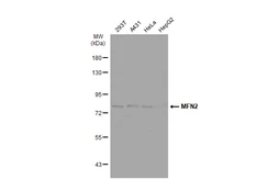 Anti-MFN2 antibody [GT1231] used in Western Blot (WB). GTX01539