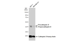 Anti-Cathepsin D antibody [GT1232] used in Western Blot (WB). GTX01540