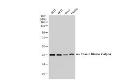 Anti-Casein Kinase 2 alpha antibody [GT1233] used in Western Blot (WB). GTX01541