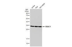 Anti-VDAC1 antibody [GT1235] used in Western Blot (WB). GTX01543