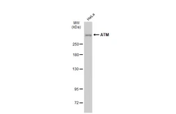 Anti-ATM antibody [GT1218] used in Western Blot (WB). GTX01544