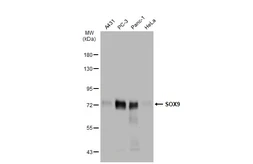 Anti-SOX9 antibody [GT1219] used in Western Blot (WB). GTX01545