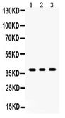 Anti-SIRT6 antibody used in Western Blot (WB). GTX01549