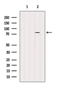 Anti-PARP2 antibody used in Western Blot (WB). GTX01558