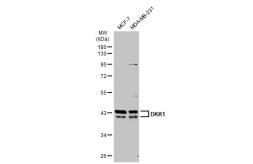 Anti-DKK1 antibody [SC06-86] used in Western Blot (WB). GTX01561
