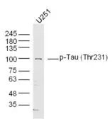 Anti-Tau (phospho Thr231) antibody used in Western Blot (WB). GTX01563
