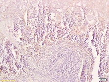 Anti-TRAIL antibody used in IHC (Paraffin sections) (IHC-P). GTX01564