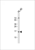 Anti-Kiss1 antibody used in Western Blot (WB). GTX01566