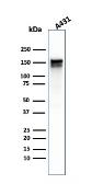 Anti-EGFR antibody [GFR/1667] used in Western Blot (WB). GTX01568