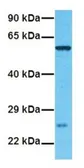 Anti-Frizzled 4 antibody used in Western Blot (WB). GTX01572