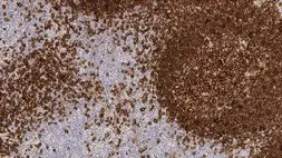 Anti-CD19 antibody [BT51E] used in IHC (Paraffin sections) (IHC-P). GTX01851