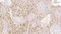 Anti-p21 Cip1 antibody [4D10] used in IHC (Paraffin sections) (IHC-P). GTX01859