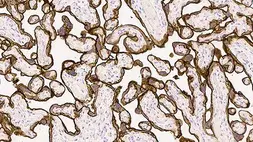 Anti-EGFR antibody [EGFR.113] used in IHC (Paraffin sections) (IHC-P). GTX01874