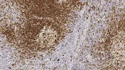 Anti-CD79b antibody [JS01] used in IHC (Paraffin sections) (IHC-P). GTX01875