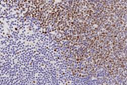 Anti-EZH2 antibody [6A10] used in IHC (Paraffin sections) (IHC-P). GTX01878