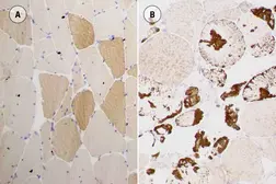 Anti-Myotilin antibody [RSO34] used in IHC (Paraffin sections) (IHC-P). GTX01881