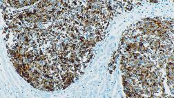 Anti-PSMA antibody [1D6] used in IHC (Paraffin sections) (IHC-P). GTX01882