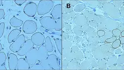 Anti-Dystrophin antibody [13H6] used in IHC (Paraffin sections) (IHC-P). GTX01888