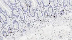 Anti-Chromogranin A antibody [5H7] used in IHC (Paraffin sections) (IHC-P). GTX01895