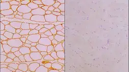 Anti-Laminin alpha 2 antibody [Mer3/22B2] used in IHC (Frozen sections) (IHC-Fr). GTX01902