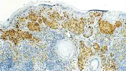 Anti-MITF antibody [34CA5] used in IHC (Paraffin sections) (IHC-P). GTX01904