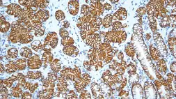 Anti-Carbonic Anhydrase IX antibody [TH22] used in IHC (Paraffin sections) (IHC-P). GTX01918