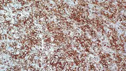 Anti-CD43 antibody [MT1] used in IHC (Paraffin sections) (IHC-P). GTX01920