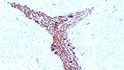 Anti-nNOS antibody [NOS-125] used in IHC (Paraffin sections) (IHC-P). GTX01921