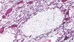 Anti-Tyrosine Hydroxylase antibody [1B5] used in IHC (Paraffin sections) (IHC-P). GTX01922