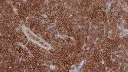 Anti-Placental Alkaline Phosphatase antibody [8A9] used in IHC (Paraffin sections) (IHC-P). GTX01925