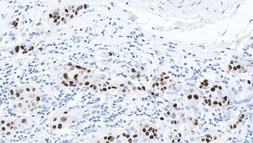Anti-Progesterone Receptor antibody [16] used in IHC (Paraffin sections) (IHC-P). GTX01926