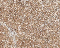 Anti-Bcl-2 antibody [bcl-2/100/D5] used in IHC (Paraffin sections) (IHC-P). GTX01935