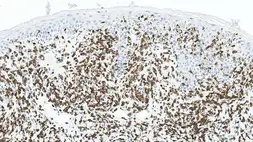 Anti-CD3 antibody [LN10] used in IHC (Paraffin sections) (IHC-P). GTX01936