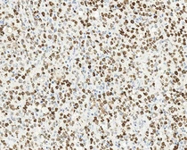 Anti-BCL6 antibody [LN22] used in IHC (Paraffin sections) (IHC-P). GTX01937