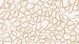 Anti-alpha Sarcoglycan antibody [Ad1/20A6] used in IHC (Frozen sections) (IHC-Fr). GTX01939